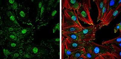 Immunocytochemistry/ Immunofluorescence: FAK [p Tyr407] Antibody [NBP3-13085]